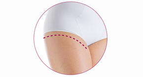 Modelado De La Faja Chicco