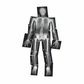 Radiografias do corpo humano
