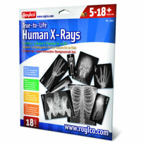 Radiografias do corpo humano